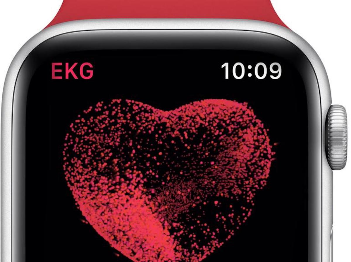 EKG auf der Apple Watch